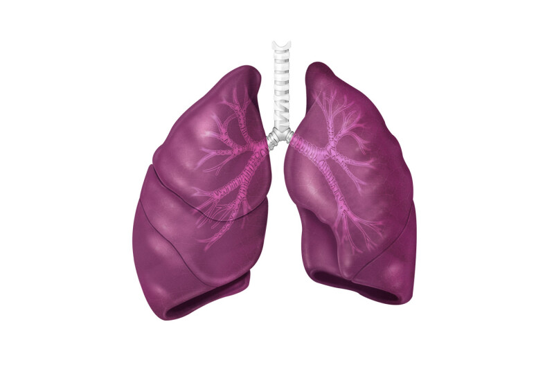 Cancer bronchique